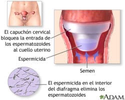 Ventajas y desventajas del capuchon cervical