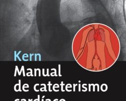 Ventajas y desventajas del cateterismo cardiaco