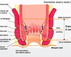 Ventajas y desventajas de manometria anorrectal de alta resolucion