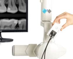 Ventajas y desventajas de la radiografía digital dental