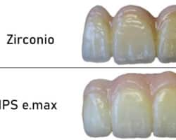 Ventajas y desventajas de la corona Emax