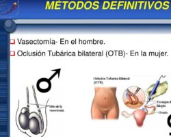 Ventajas y desventajas de métodos definitivos o quirúrgicos.